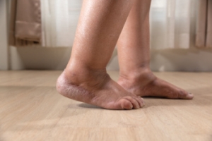 Possible Causes of Swollen Feet