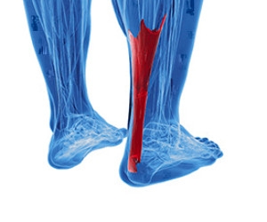Have I Ruptured My Achilles Tendon?