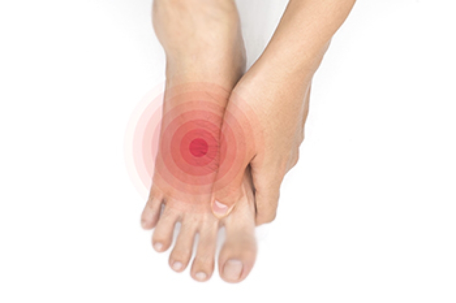 Dealing With Neuropathic Foot Ulcers