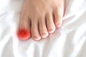 Causes of an Ingrown Toenail