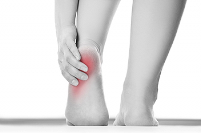 Bursitis A Real Pain in the Heel
